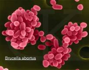 Brucellosis - Hình ảnh minh họa